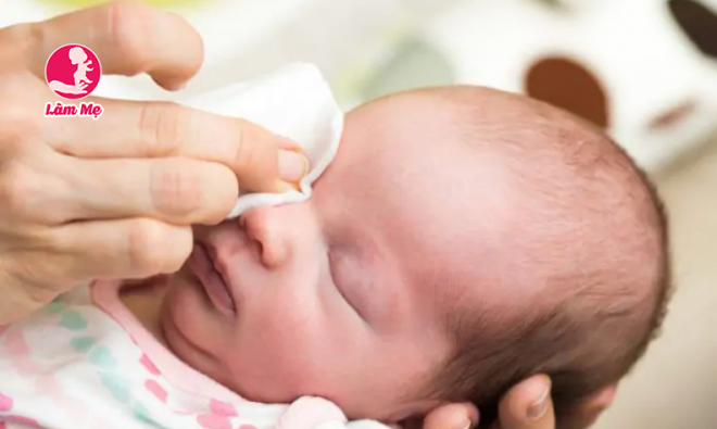 Mắt trẻ sơ sinh đổ ghèn: Phương pháp vệ sinh mắt bé đúng cách